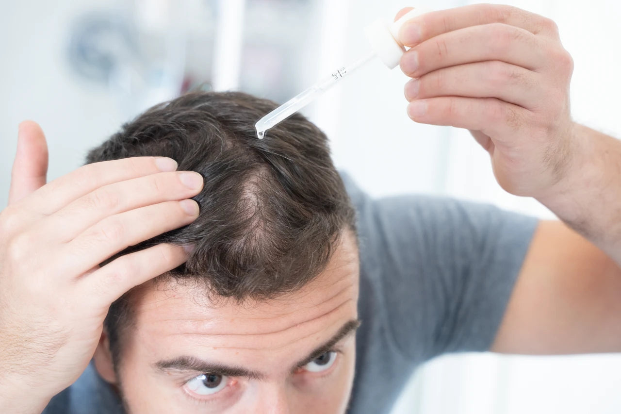Man using hair loss treatment