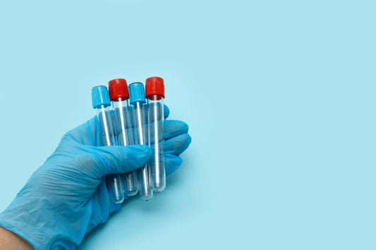 test tubes for sperm analysis