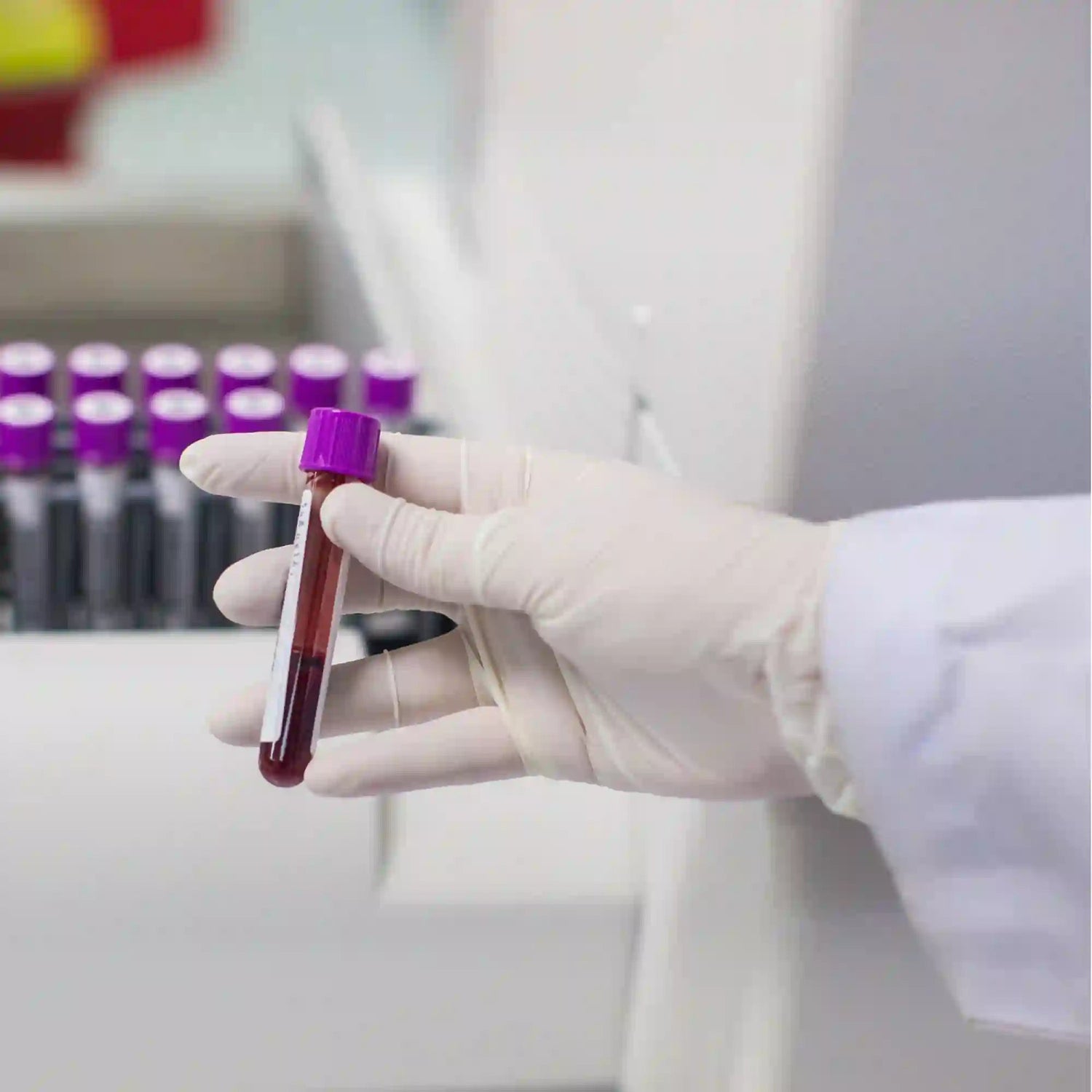 A gloved hand holds a vial of blood from an STD Testing panel