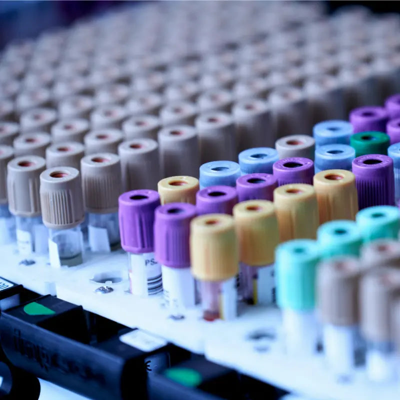 Image shows many semen vials being prepared for cryopreservation processing