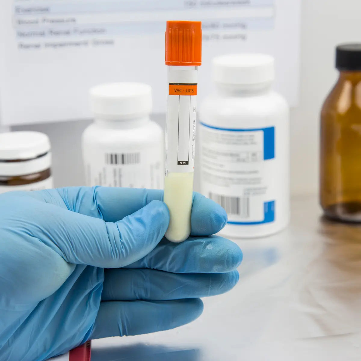 Test tube with a yellow liquid held by a gloved hand in a laboratory setting.